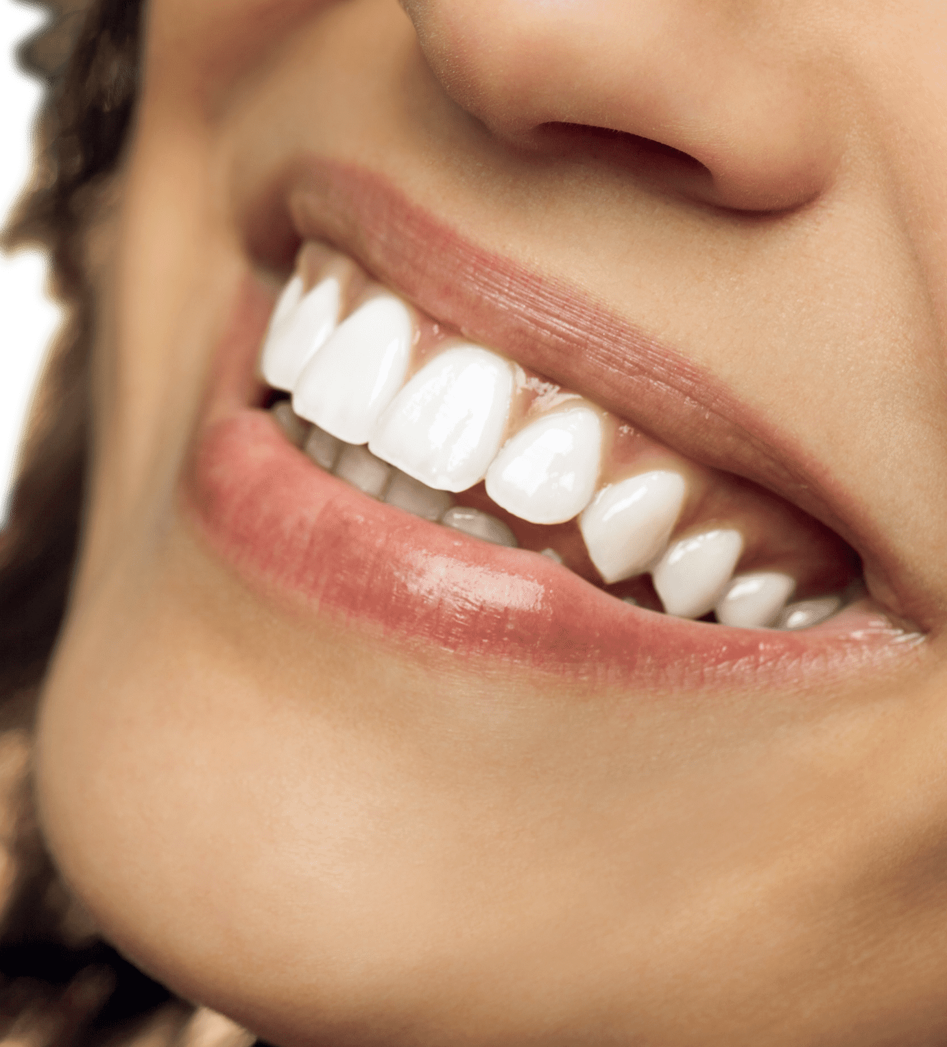 Bleichen | Zahnaufhellung